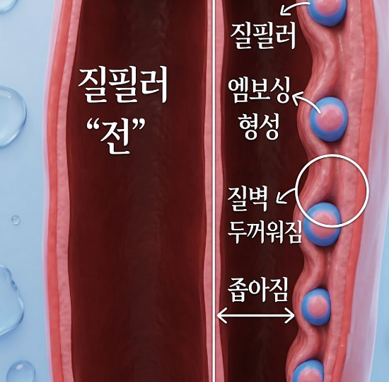 질필러와 레이저 타이트닝은 무엇이 다른가요? 관련 해부 구조 그림