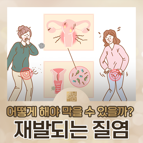 질염이 자꾸 재발한다면 무엇을 확인해야 하나요?