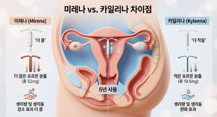 미레나 카일리나 임플라논, 나에게 맞는 피임법 고르는 기준은? 관련 해부 구조 그림