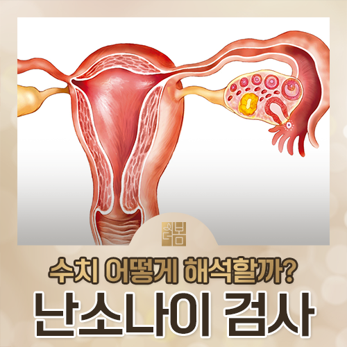 난소나이검사, 결혼 전에 받아야 할까요?